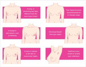 Breast-Cancer-Symptoms